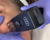 Image for Radio Frequency section