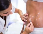 exploring non invasive body contouring solutions