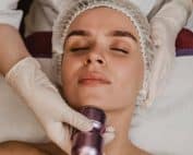 unlock youthful skin morpheus8 for fine lines and wrinkles