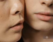 Learn how Morpheus8 customizes treatments to address wrinkles, scars, and uneven tone. Trust Bodify for personalized care and radiant skin. Contact us today!