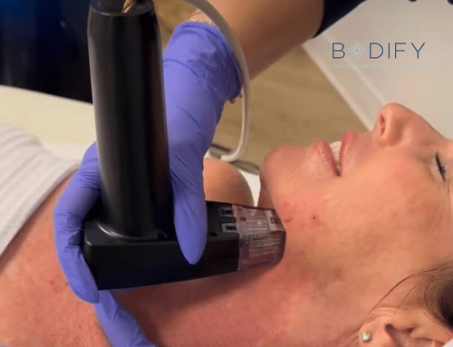 What Are the Benefits of Ongoing Morpheus8 Maintenance Sessions in Phoenix?